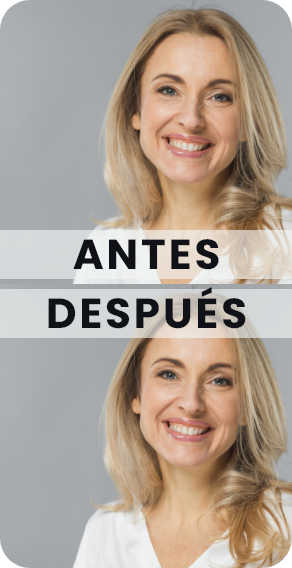 antes-y-despues.png